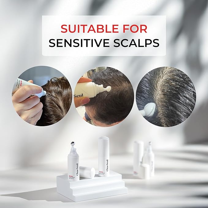 ChaeSeul Revhan Scalp Serum for Hair Loss & Thinning – Hair Growth Serum for Men & Women w/Salicylic Acid & Centella Asiatica – Soothes Itchy, Irritated Scalp with Roll-On