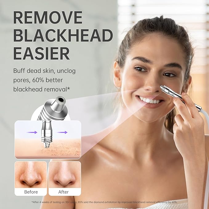 UNOISETION Blackhead Vacuum Removers, 2 in 1 Pro-Grade At-Home Spa Facial Vacuum Pore Cleaner for Blackheads, Whiteheads, Exfoliation, 20-80 Kpa Adjustable Suction for All Skin Types, White