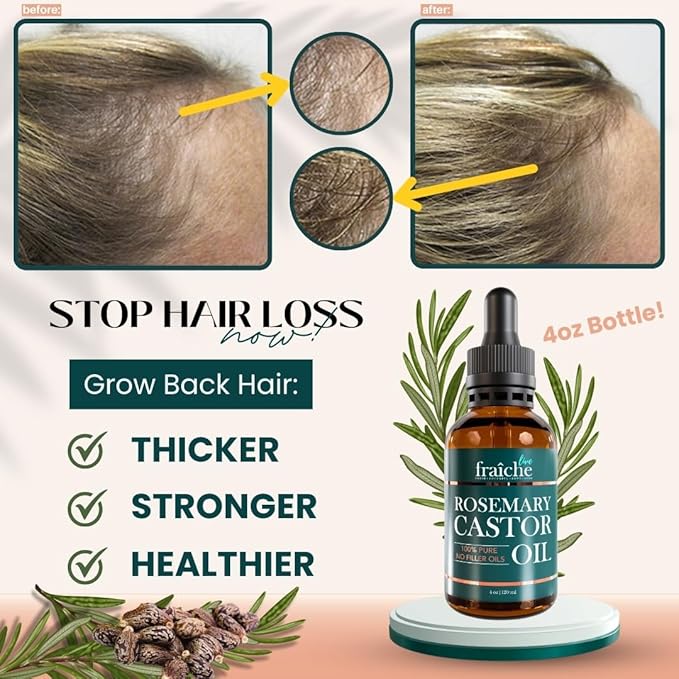 Rosemary Castor Oil for Hair Growth Glass Bottle, Hair Oil for Hair Growth