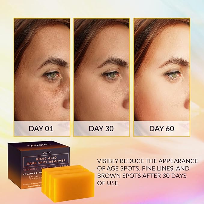 Valitic Kojic Acid Dark Spot Remover Soap Bars with Vitamin C, Retinol, Collagen, Turmeric - Original Japanese Complex Infused with Hyaluronic Acid, Vitamin E, Shea Butter, Castile Olive Oil (3 Pack)