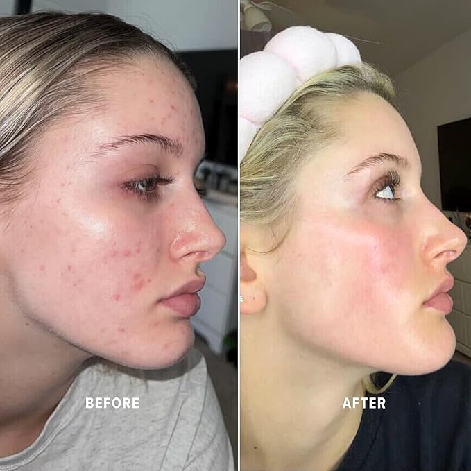 Kay's Glow Serum - Vitamin C Serum for Face with Stable THD Ascorbate & Oxygen Brightening Glow Face Serum - Hydrating Dark Spot Serum + AHA Discoloration Corrector - Glass Skin, 1 oz