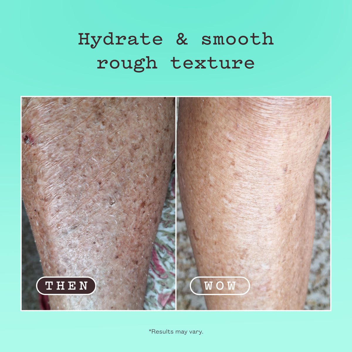 Frank Body Smoothing AHA Body Lotion | Vegan, Cruelty Free, Body Exfoliant | Fights Breakouts and Hydrates Skin with Lactic & Glycolic Acids, Hydrating Oils, & Mango Seed Butter | 4.73 fl oz / 140 ml