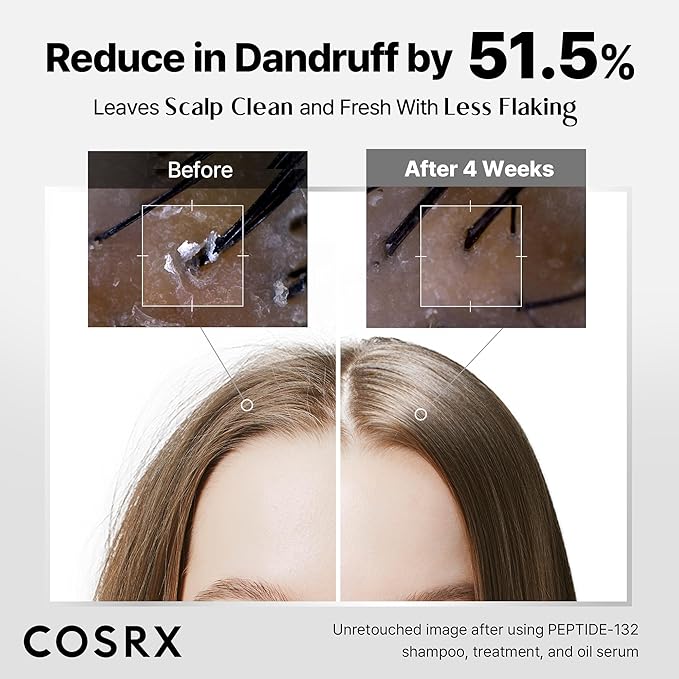 COSRX PEPTIDE 132 Hair Bonding Shampoo, Dandruff Scalp Care, 6.76 fl oz