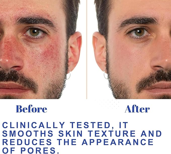 Wellness Heavens Hydrating Korean Facial Toner with Witch Hazel, Aloe Vera & Glycolic Acid – Alcohol Free Face Mist for Dry & Sensitive Skin, Pore Minimizing Daily Toner for Glowing Skin - 100ml