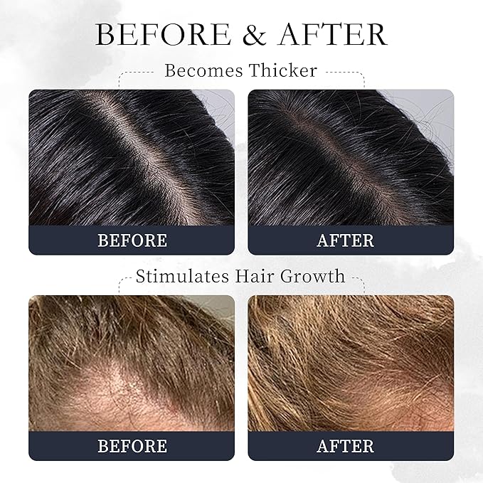 Novastile Rosemary Hair Oil – Dry Scalp & Split End Treatment with Biotin & Essential Oils for Strengthening, Nourishing, Moisturizing & Supporting Longer, Healthier Hair
