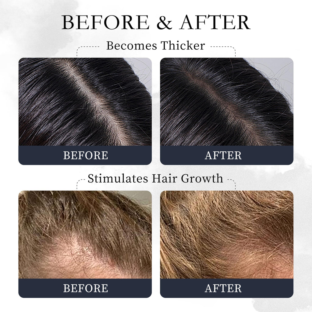 Novastile Rosemary Hair Oil – Dry Scalp & Split End Treatment with Biotin & Essential Oils for Strengthening, Nourishing, Moisturizing & Supporting Longer, Healthier Hair