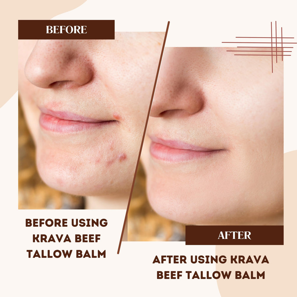 Krava Naturals Beef Tallow for Skin, Beef Tallow for Face, Whipped Tallow Balm, Beef Tallow Moisturizer - Tallow Face Moisturizer, Tallow Cream | 100% Grass Fed, Unscented, 2 oz