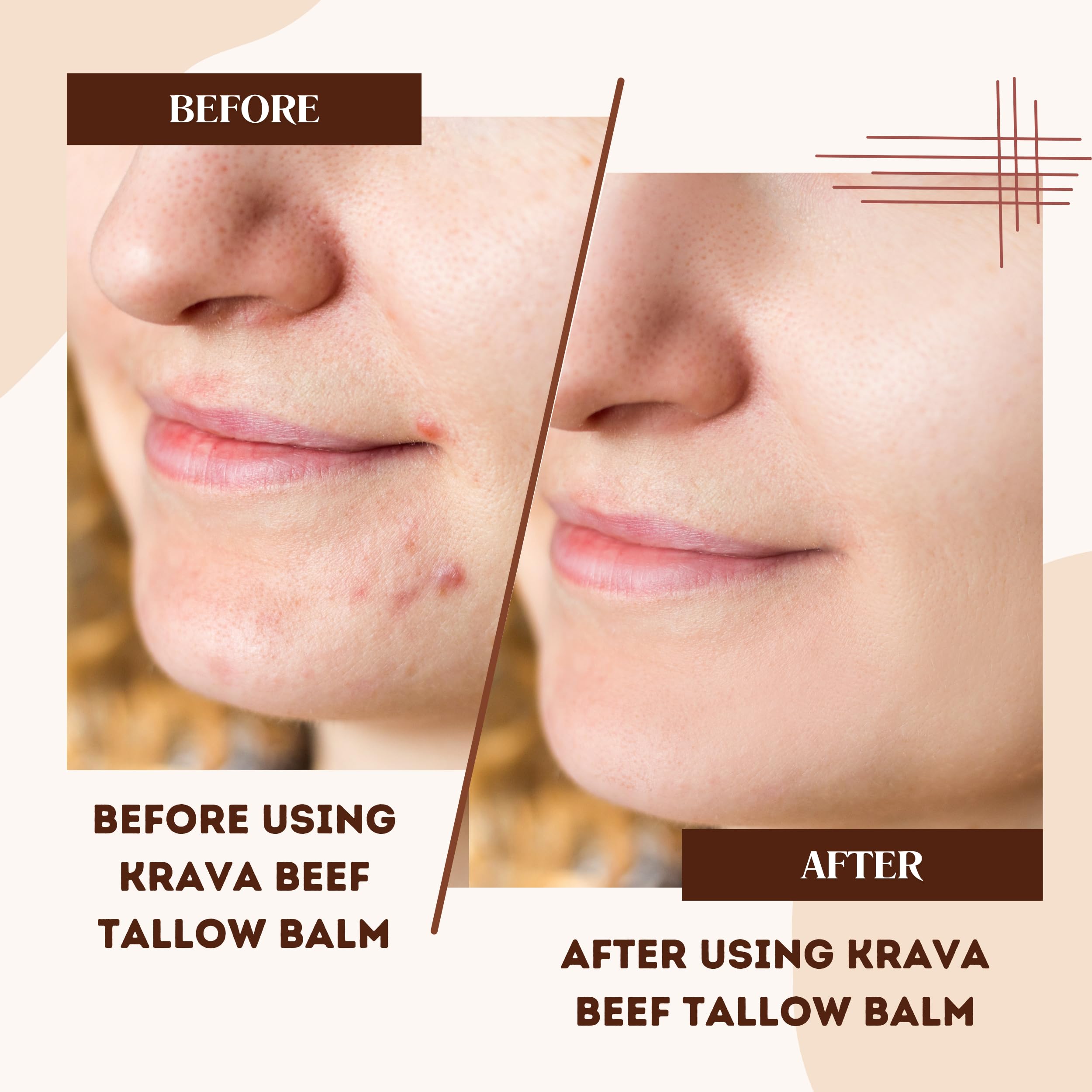 Krava Naturals Beef Tallow for Skin, Beef Tallow for Face, Whipped Tallow Balm, Beef Tallow Moisturizer - Tallow Face Moisturizer, Tallow Cream | 100% Grass Fed, Unscented, 2 oz
