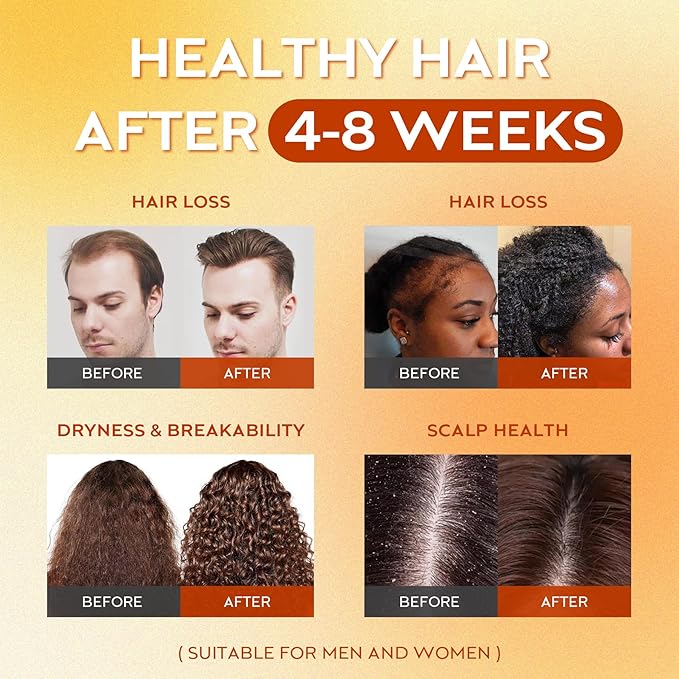 WEEMOTD 100% Raw Batana Oil for Hair, Unrefined Conditioning Scalp Oil from Honduras, Moisturizing Hair Mask, Adds Shine & Softness for Men & Women (2 Fl Oz, Bright Coffee)