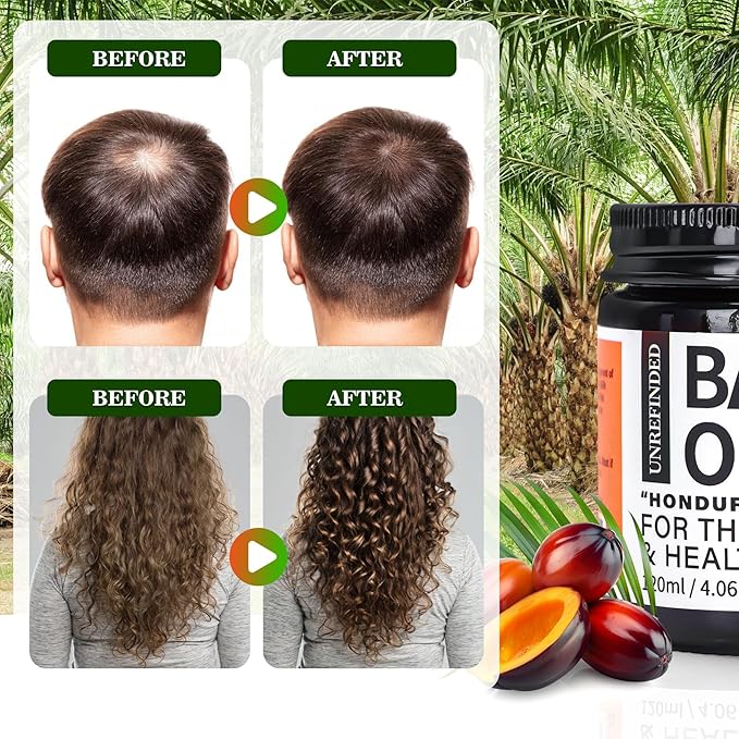 Organic Batana Oil for Hair Growth, 100% Pure Batana from Honduras, Hair Treatment Oil for Thick and Strong Hair,