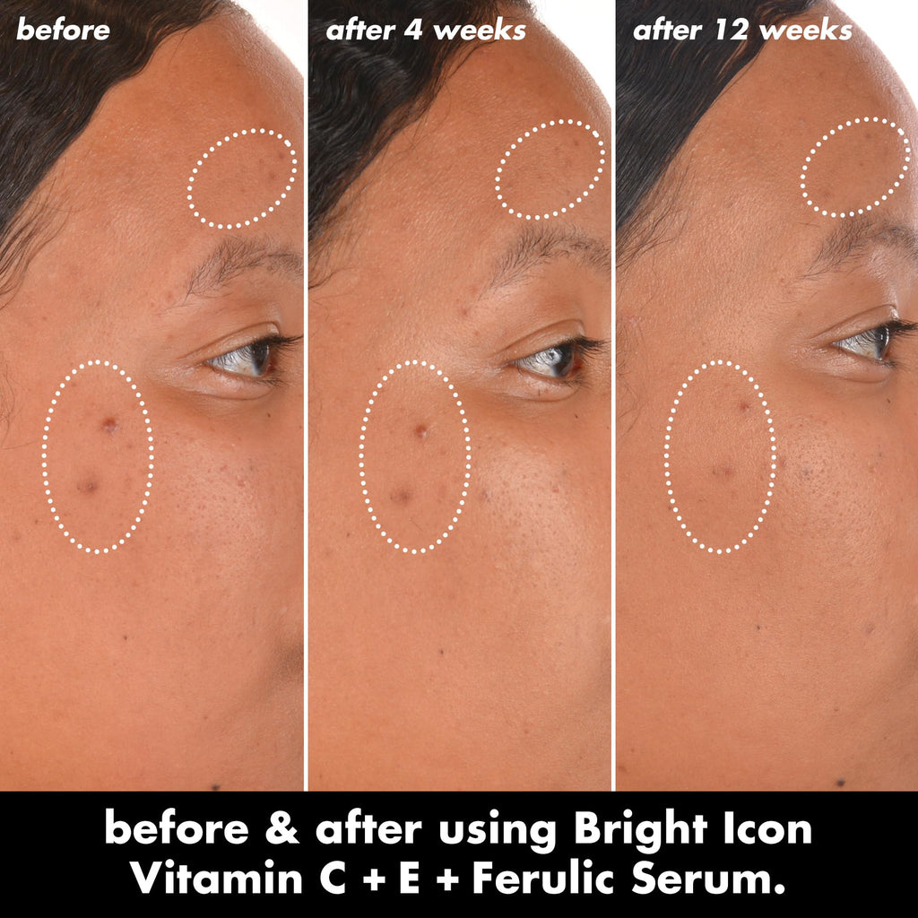 e.l.f. SKIN Bright Icon Vitamin C + E + Ferulic Serum, 1 oz