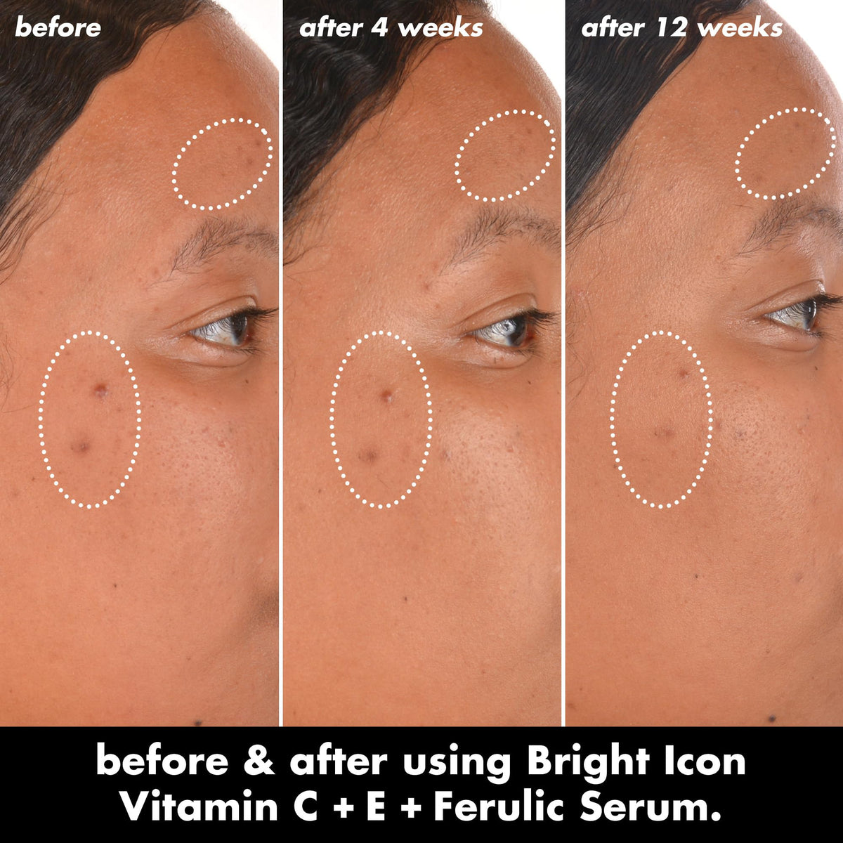 e.l.f. SKIN Bright Icon Vitamin C + E + Ferulic Serum, 1 oz