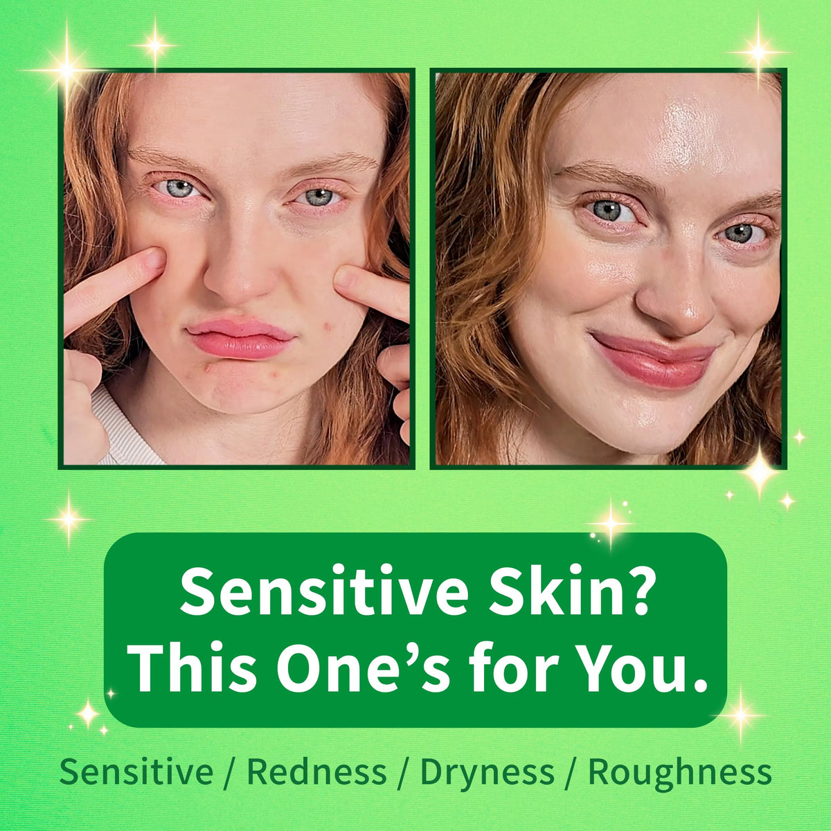 EARTHAT Barrier Repair Cream, Redness Relief for Sensitive Skin