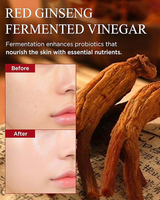 DANAHAN Bonyongo Red Ginseng Vinegar Toner, Niacinamide, Dry Skin, 5 fl oz