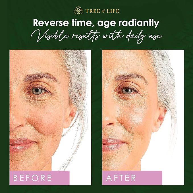 Tree of Life Retinol Serum for Face - Brightening and Hydrating Face Oil for Dark Spots and Fine Lines - Suitable for Sensitive Skin - Dermatologist Tested Skin Care - 2 Fl Oz