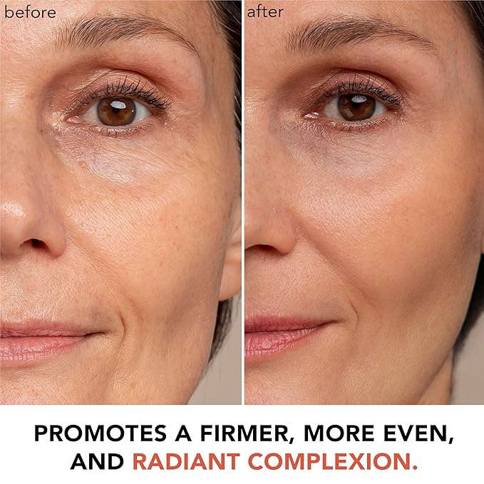 Vitamin C Face Cream - USA Made with Organic & Natural Ingredients