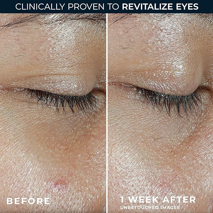 RoC Multi Correxion Revive + Glow Eye Balm with Vitamin C (0.14 oz) + Retinol Eye Cream Packette