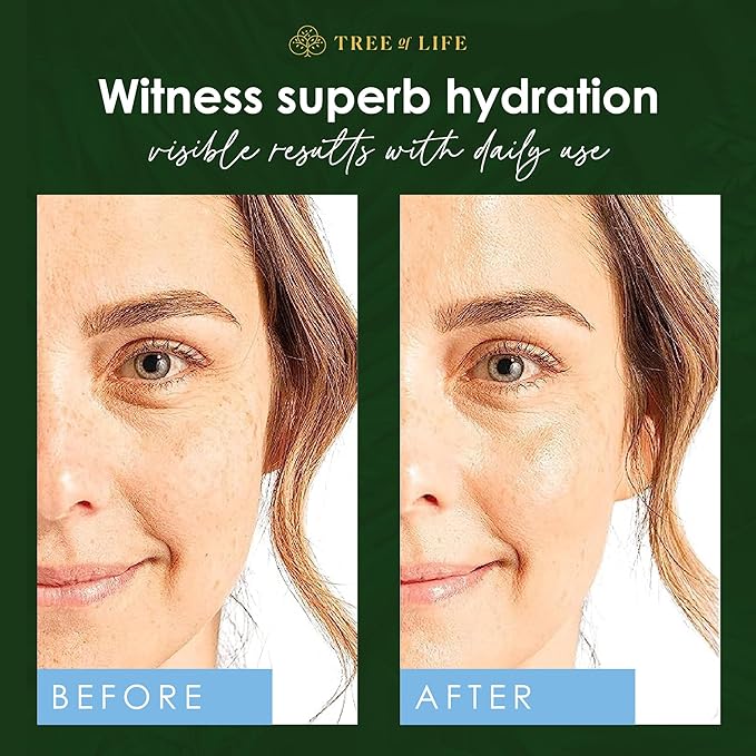 Tree of Life Hyaluronic Acid Serum for Face - Brightening and Hydrating Face Oil for Dark Spots and Fine Lines - Suitable for Sensitive Skin - Dermatologist Tested Skin Care - 1 Fl Oz
