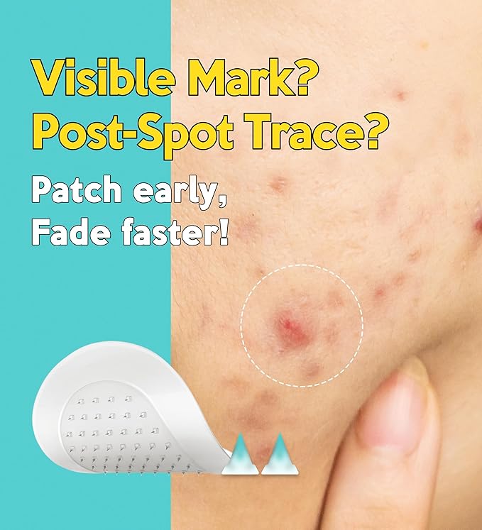 Troubless Micro Patch Plus - 10% Vitamin C Zit Hydrocolloid Patch 9EA