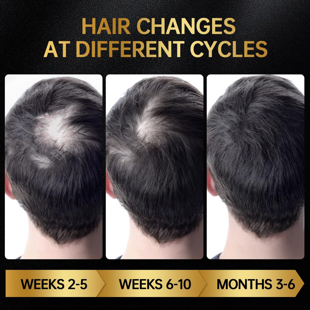 Minoxidil for Men & Women, With Biotin, Batana Oil, Rosemary Essential Oil, Effective Hair Loss Solution, Hair Loss Treatment for Hair Regrowth, Non-Greasy 5% Minoxidil - 60ml(Single Bottle Serum)