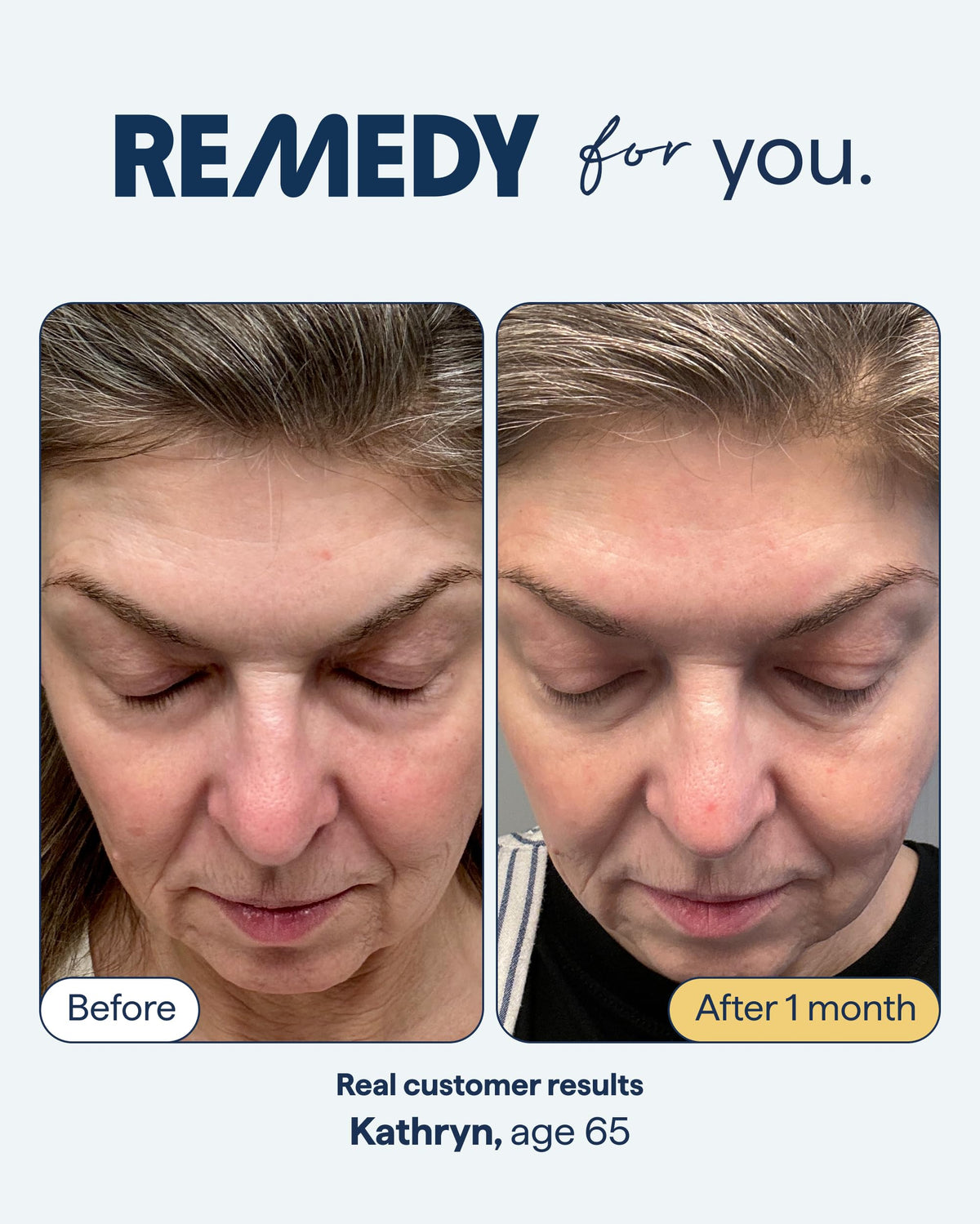 REMEDY for Healthy Aging, Serum for Wrinkles, Uneven Texture and Tone