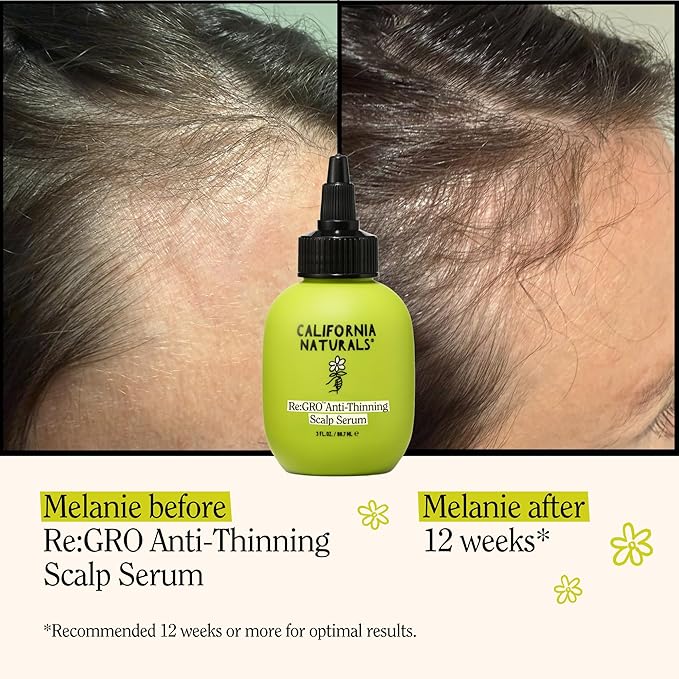 California Naturals Women's ReGRO Anti-Thinning Scalp Serum, 5% Capixyl with Biotin, Caffeine & Castor and Rosemary Oil, Non-Sticky Cooling Formula, Vegan & Cruelty Free, 3oz