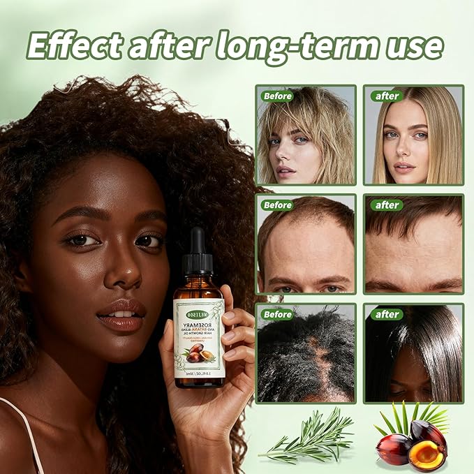 UPsyussa 2 Pack Organic Batana Rosemary Oil for Hair Growth & Anti-Hair Loss, 2PCS 1 fl oz Natural DHT Blocker Scalp Treatment for Thinning Hair, Nourishing Dry Scalp & Strengthening Follicles