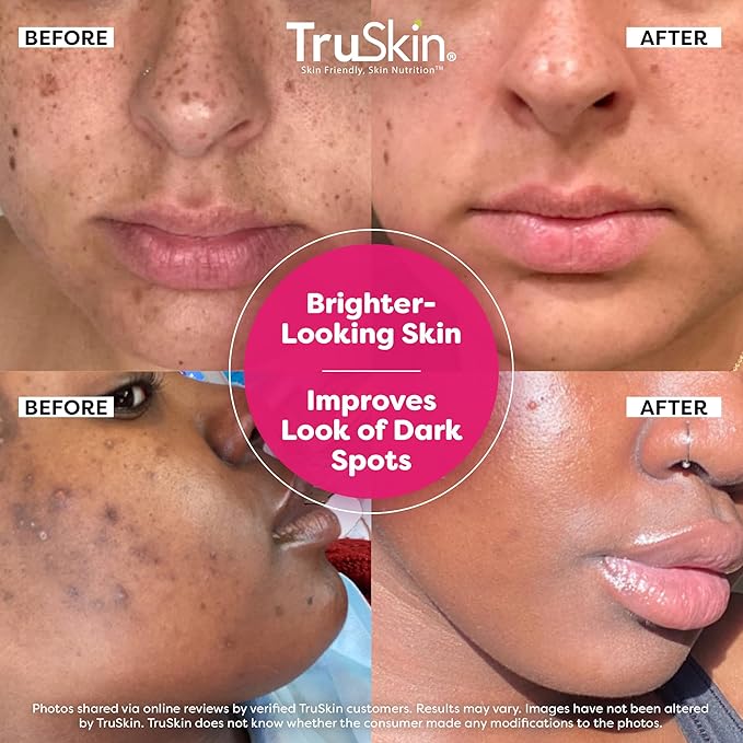 TruSkin Vitamin C Super Serum for Face, 5 Skin Benefits, 2 fl oz