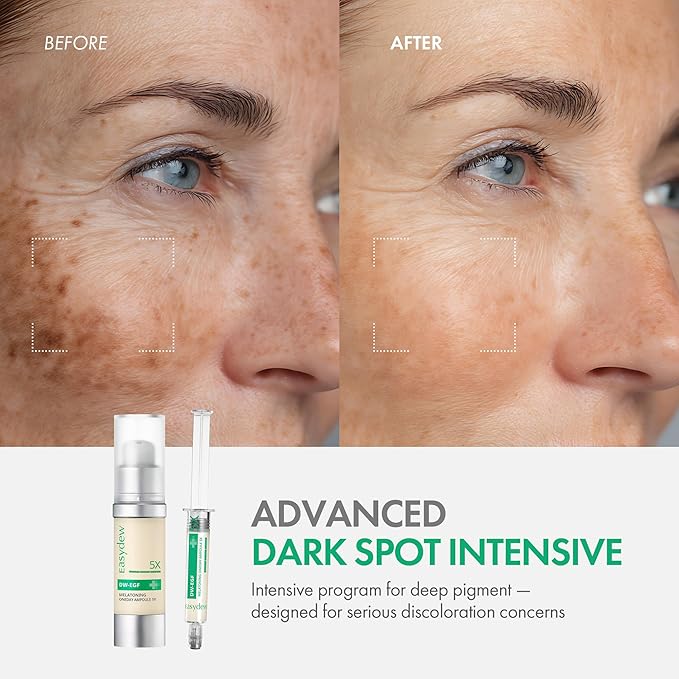 Easydew DW-EGF Melatoning Ampoule 5X - Dark Spot Serum (Bottle 1.01 fl oz)
