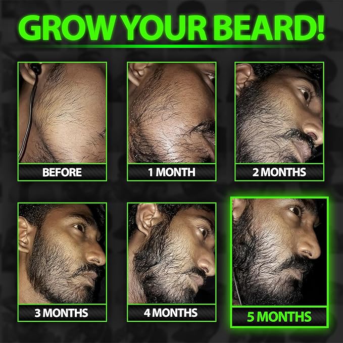 Biotin Beard Balm + XXL Beard Growth Serum + 620,000mcg Beard Growth Vitamins – Beard Kit for Men with Mustache Wax, Collagen, MSM & Castor Oil – Fills Patches, Thickens & Styles