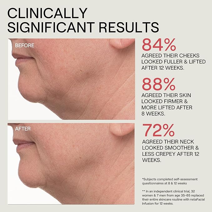 Dr. Diamond's Metacine InstaFacial Discovery Trio | Plasma Bioactive Growth Factor Serum | Emulsion Retinopro Growth Factor Night Cream | Infusion Biomimetic Collagen Serum for Repaired, Lifted Skin