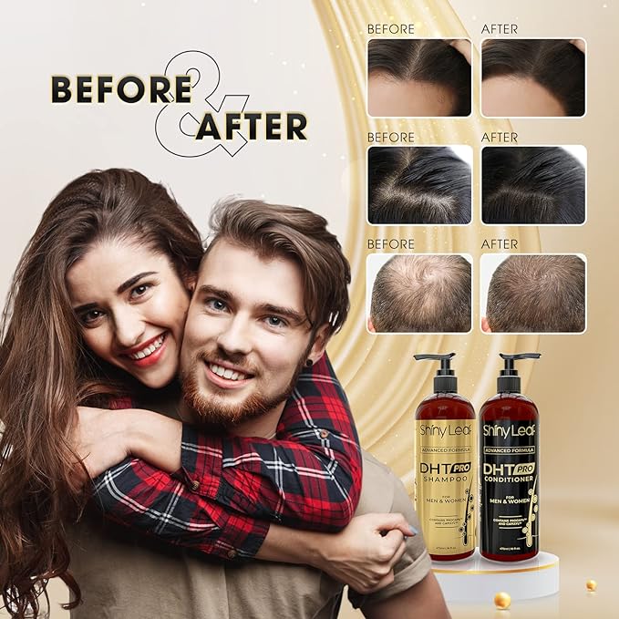 Shiny Leaf Hair Loss Conditioner, Biotin & DHT Blocker, Sulfate Free, 16 oz