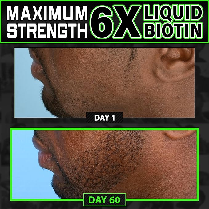 Biotin Gummies 620,000mcg + Liquid Biotin Drops with Collagen Peptides – Men's Beard Growth Kit for Thicker Fuller Beard – Beard & Hair Growth Vitamins with MSM, Keratin, Bamboo & Zinc