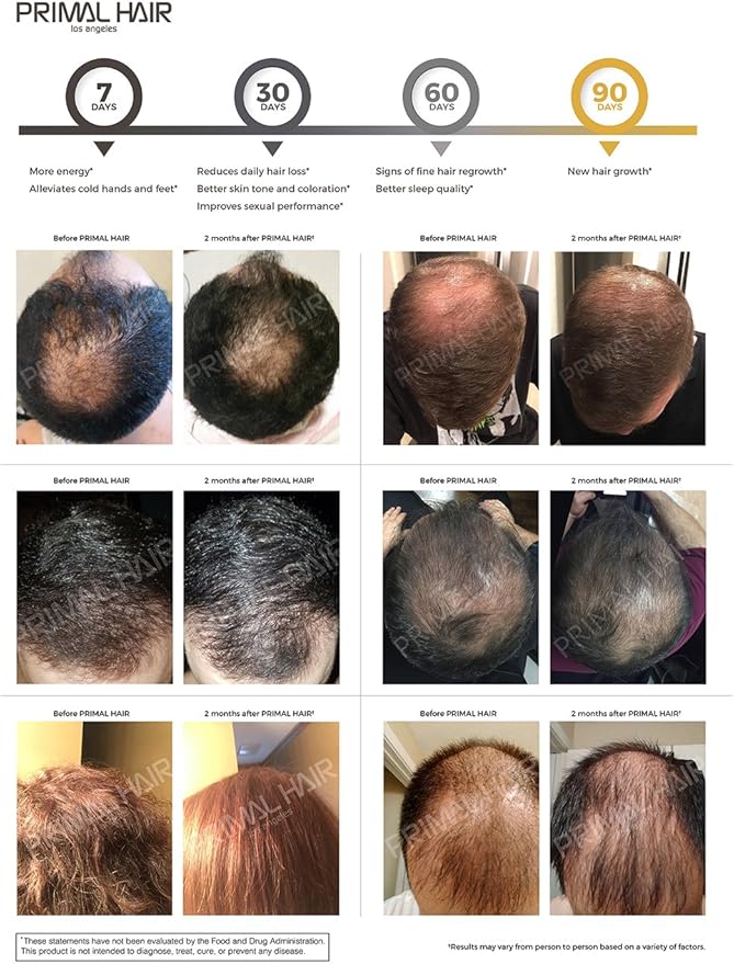 Primal Hair Natural Hair Growth Supplement for Men & Women - US Patented Botanical Formula for Thicker Fuller Hair - Anti-Hair Loss & Scalp Wellness - 100% Vegan, Non-GMO - 120ct (30-Day Supply)