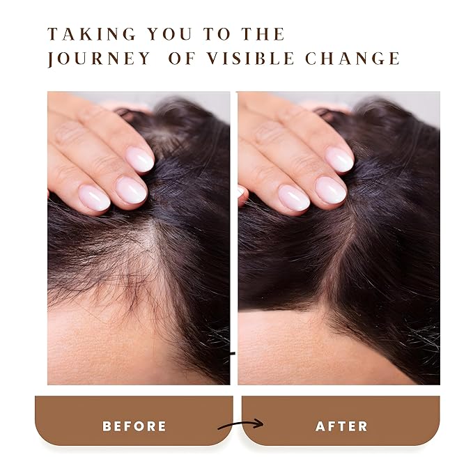 The Oily Tonic Rosemary Revival Oil – Premium Scalp & Hair Rejuvenation for Thinning, Dry, or Damaged Hair – 30% Rosemary + Squalane + Vitamin E – Nourish, Regenerate & Add Shine – 1.7oz