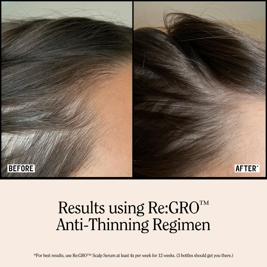 California Naturals Re:GRO Anti-Thinning Shampoo & Conditioner Set for Women, Biotin, Caffeine & Rosemary Oil, Hair Loss & Thinning Support, Sulfate Free, 20 fl oz