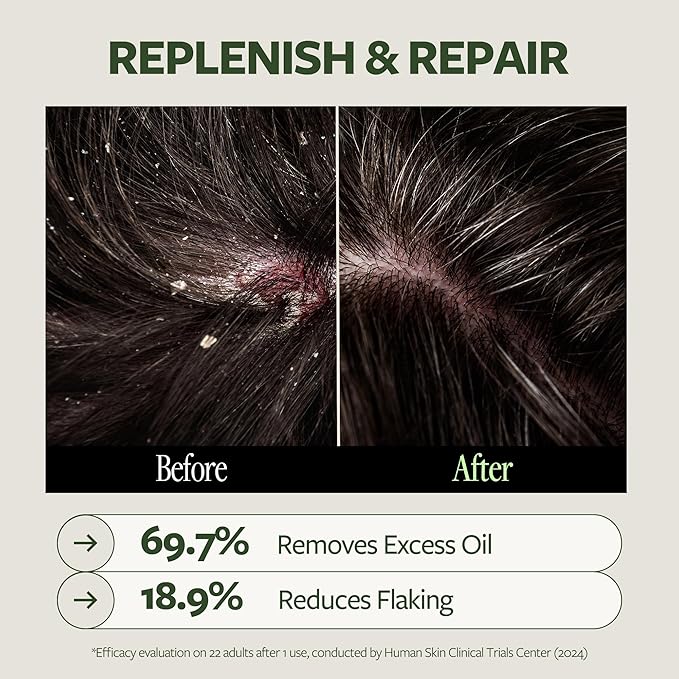 LAPCOS K Beauty DR.14 Revitalizing Scalp Care Shampoo - Clarifying & Hydrating Shampoo for Thicker Strands & Buildup Control with Biotin, Collagen & Botanical Oils -Korean Hair Care 16.23 fl oz