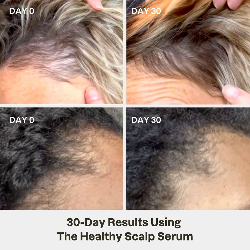 Love Ur Curls Healthy Scalp Serum - Moisturizing for Thicker Fuller Hair