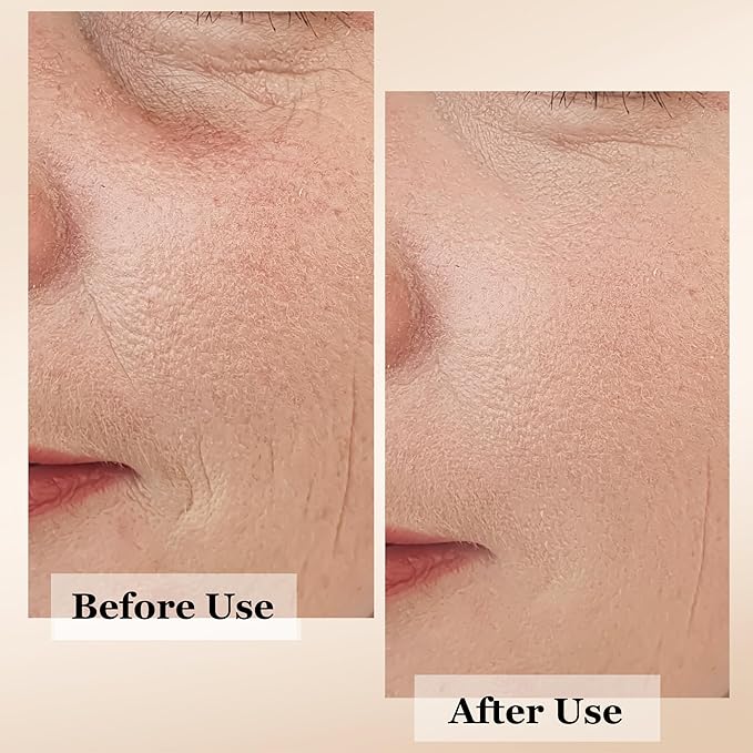 mivida 4-in-1 Anti-Aging Serum for face | Retinol, Vitamin C, Hyaluronic Acid & RoseHip Oil | multi benefit Face Serum – 1 Fl Oz