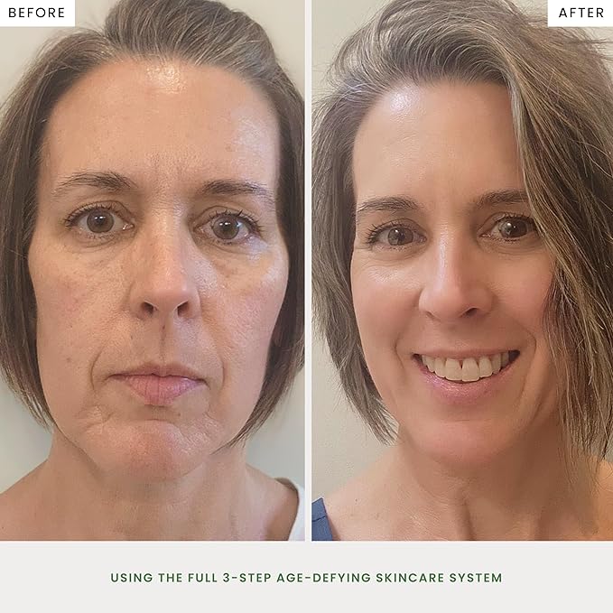 The Spa Dr. Antioxidant Serum - Anti Aging Skin Care - 30 Day Supply - Safe For All Skin Types - Perfectly pH Balanced - Organic Skin Care - Step 2 Nourish - 30 ML / 1 Fl. Oz.