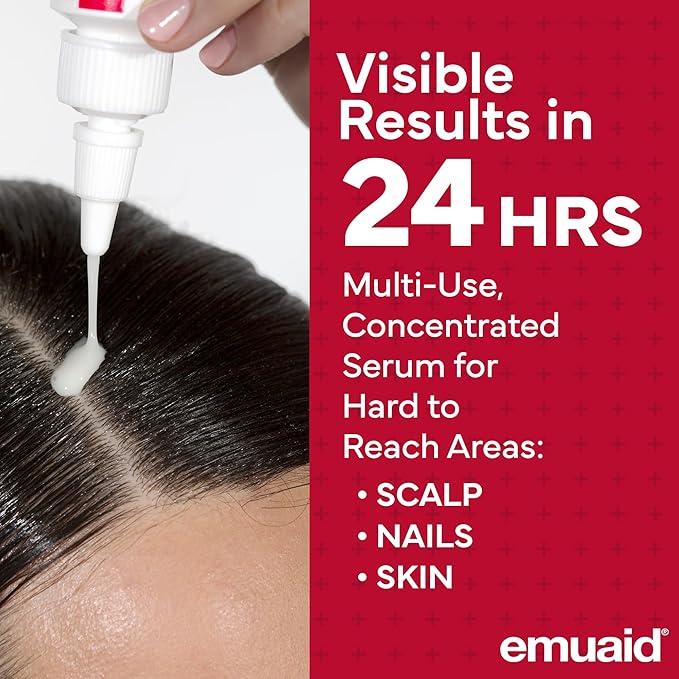 EMUAIDMAX Psoriasis Scalp Treatment Serum for Eczema and Dermatitis, 1oz