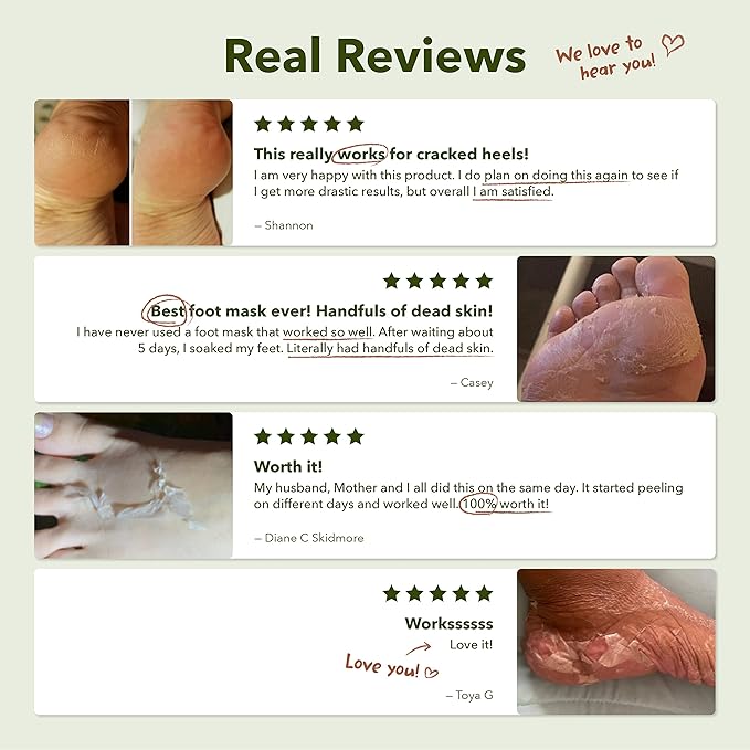 Purederm Foot Peeling Mask for Dry Cracked Feet, Exfoliating Treatment for Dead Skin & Calluses for Baby Soft Feet, 6 Pairs
