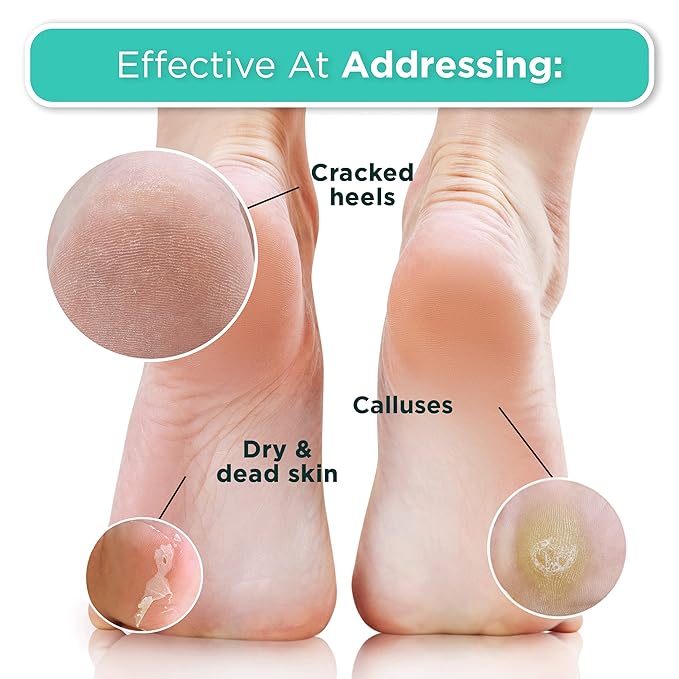 DERMORA Foot Peel Mask, Exfoliating Foot Peeling Mask, 2 Pairs,Tea Tree