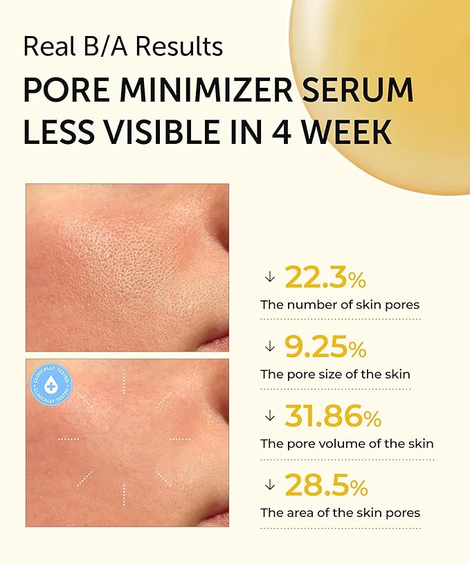 SERUMKIND Yellowmello Drop Serum, Pore Refining with Salicylic Acid, Hydration & Skin Balance, Korean Skincare (1.01 fl oz / 30 ml)