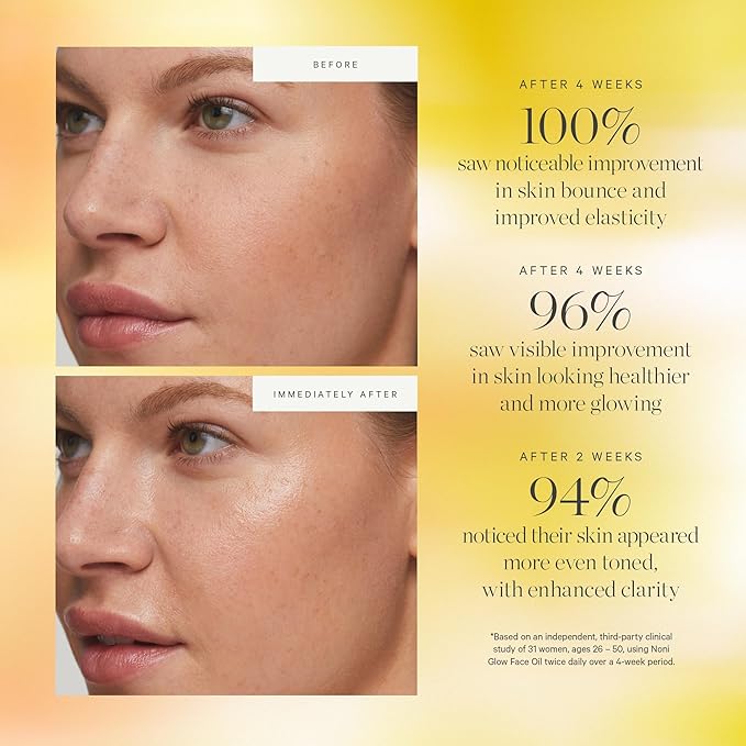KORA Organics Noni Glow Hydrating Face Oil for All Skin Types, Lightweight Fast-Absorbing Facial Oil with Rosehip, Jojoba & Sea Buckthorn Oils for Smooth & Radiant Looking Skin, 0.34 fl oz