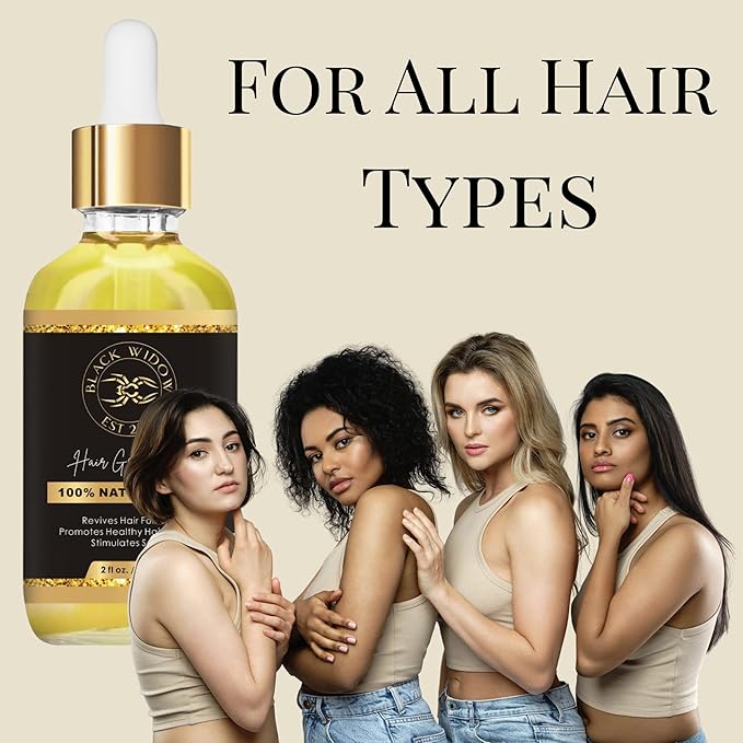 Black Widow Rosemary Mint Scalp & Hair Oil, 2 Oz, with Castor, Jojoba, Peppermint & Vitamin E, for Dry Scalp, Split Ends & Stronger-Looking Hair, All Hair Types