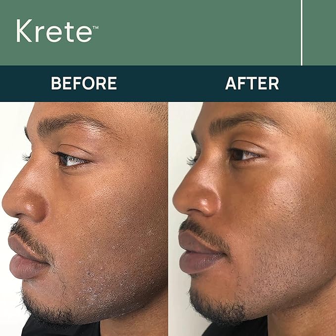 krete One-Two Punch with Probiotic Facial Cleanser & Facial Serum for Men – Moisturize, Hydrate, and Protect Your Skin in 30 Seconds