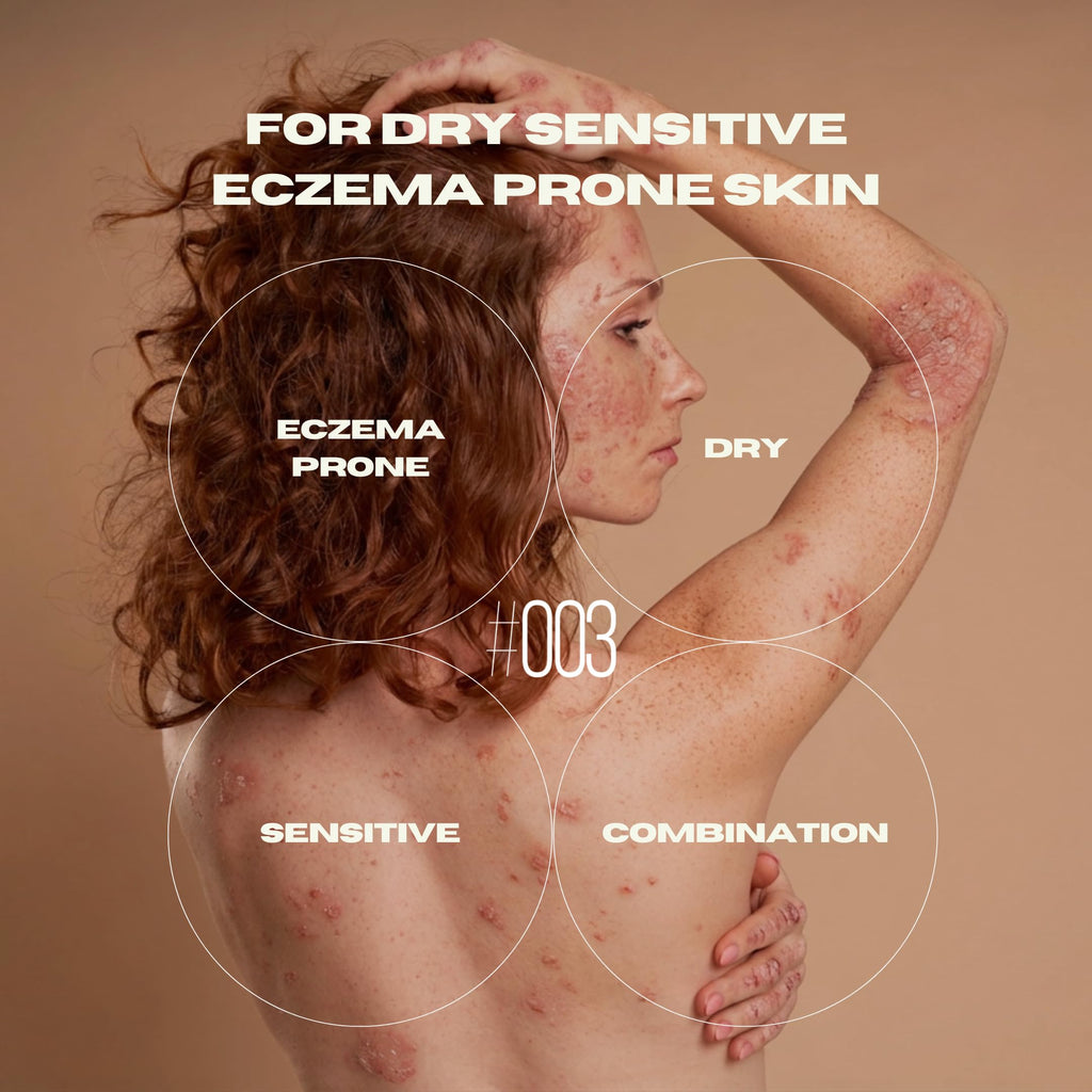 Dr. Arsy Natural Moisturizer #003 for Dry Sensitive Eczema-Prone Skin, 4 oz