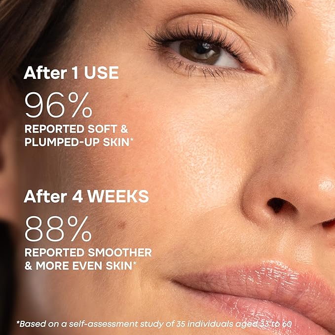 SimplyVital Collagen, Retinol & Hyaluronic Acid Serum - Anti-Aging Moisturizer for Face, Neck & Décolleté - Deep Moisturizing Skin Care Complex - Hydrating Facial Serum for Women, 1 fl.oz