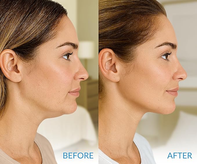 Stylia MaxiLift V-Line Lifting Collagen Face Mask - Double Chin Strap - Jawline Shaper - Neck Firming and Tightening Mask with Hyaluronic Acid & Aloe Vera - Chin Strap for Sleeping (5PC)